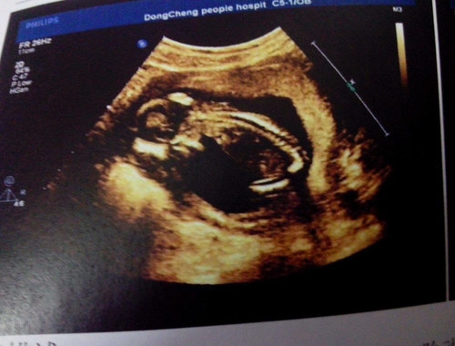 关于母亲怀胎十月的诗 关于母亲怀胎十月的诗