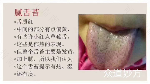 孩子有积食舌苔厚